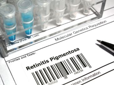 Retinitis Pigmentoza (Tavuk karası)